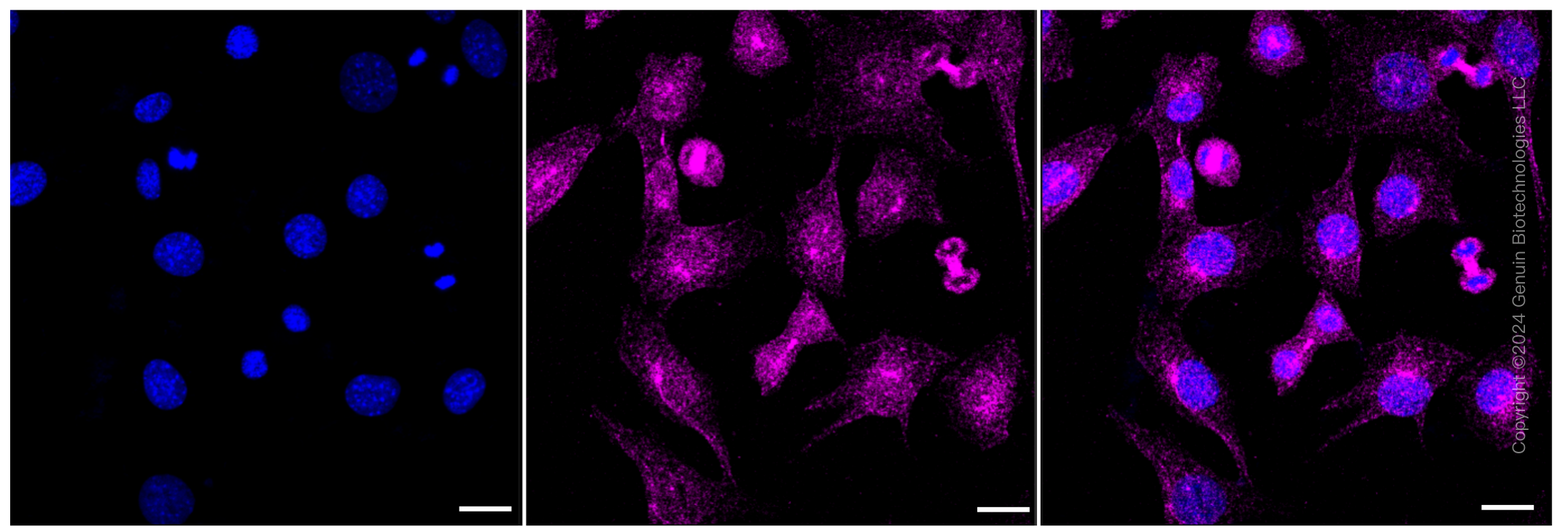 KD-Validated Anti-Calpain 1 Rabbit Monoclonal Antibody ABG1193