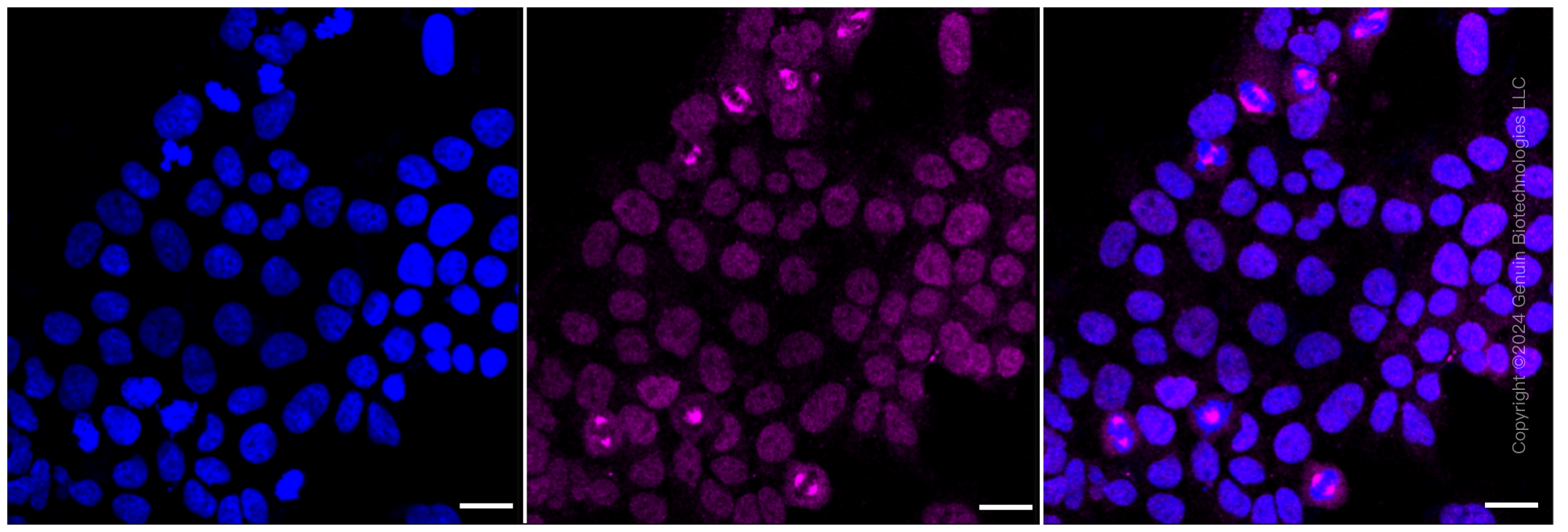 KD-Validated Anti-Carbonic anhydrase II Rabbit Monoclonal Antibody ABG1195