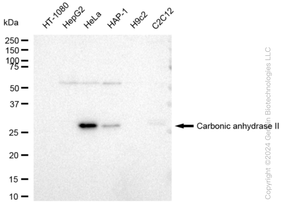 KD-Validated Anti-Carbonic anhydrase II Rabbit Monoclonal Antibody ABG1195