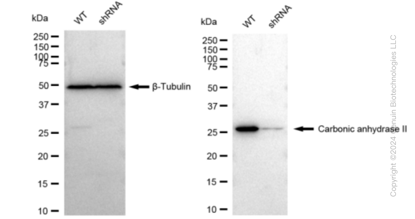 KD-Validated Anti-Carbonic anhydrase II Rabbit Monoclonal Antibody ABG1195