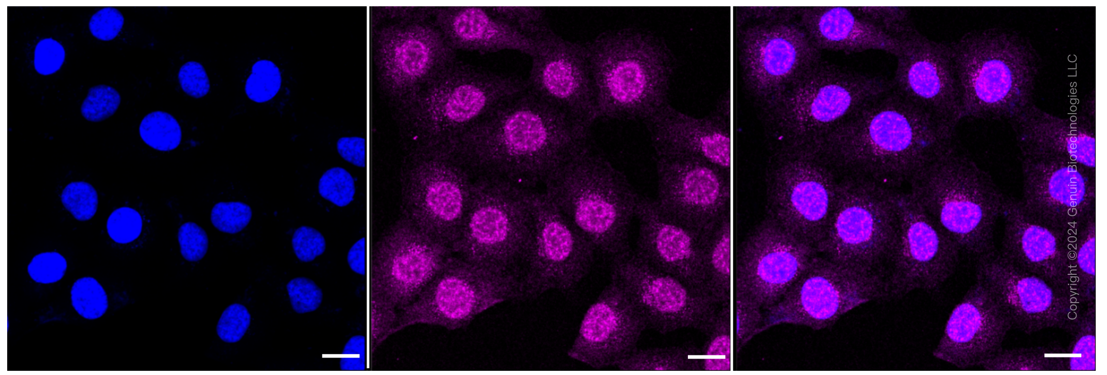 KD-Validated Anti-Calpain 2 Rabbit Monoclonal Antibody ABG1196