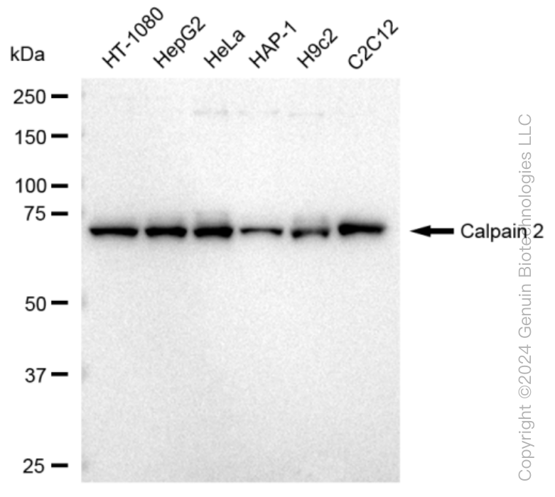 KD-Validated Anti-Calpain 2 Rabbit Monoclonal Antibody ABG1196