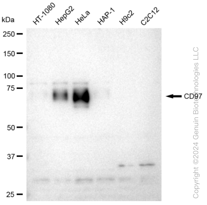 KD-Validated Anti-CD97 Rabbit Monoclonal Antibody ABG1198