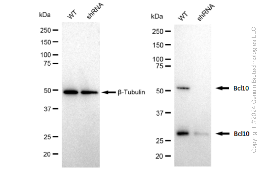 KD-Validated Anti-Bcl10 Rabbit Monoclonal Antibody ABG1204