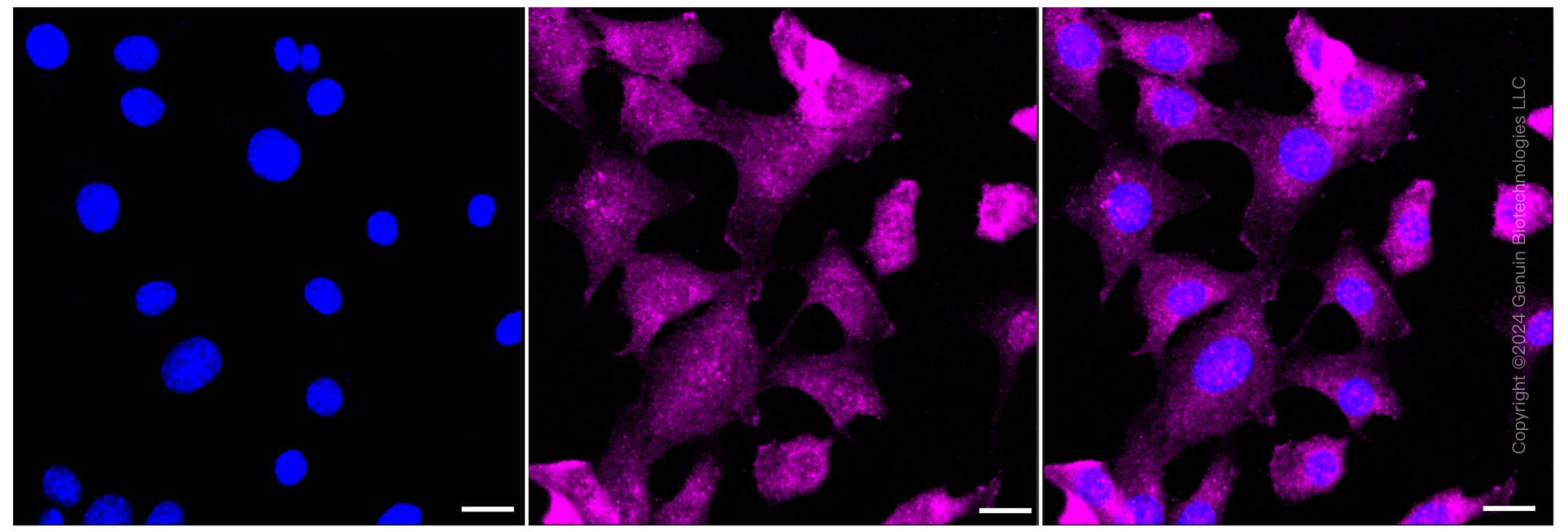 KD-Validated Anti-CSDE1 Rabbit Monoclonal Antibody ABG1206