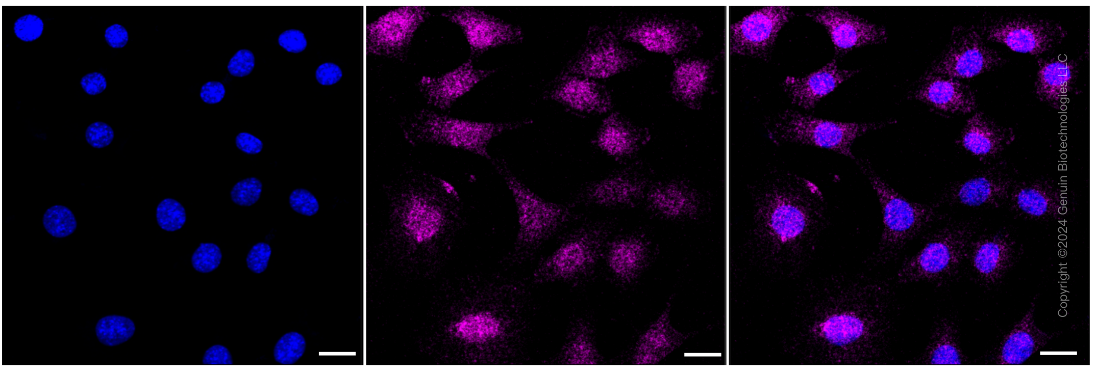 KD-Validated Anti-CBX2 Rabbit Monoclonal Antibody ABG1210