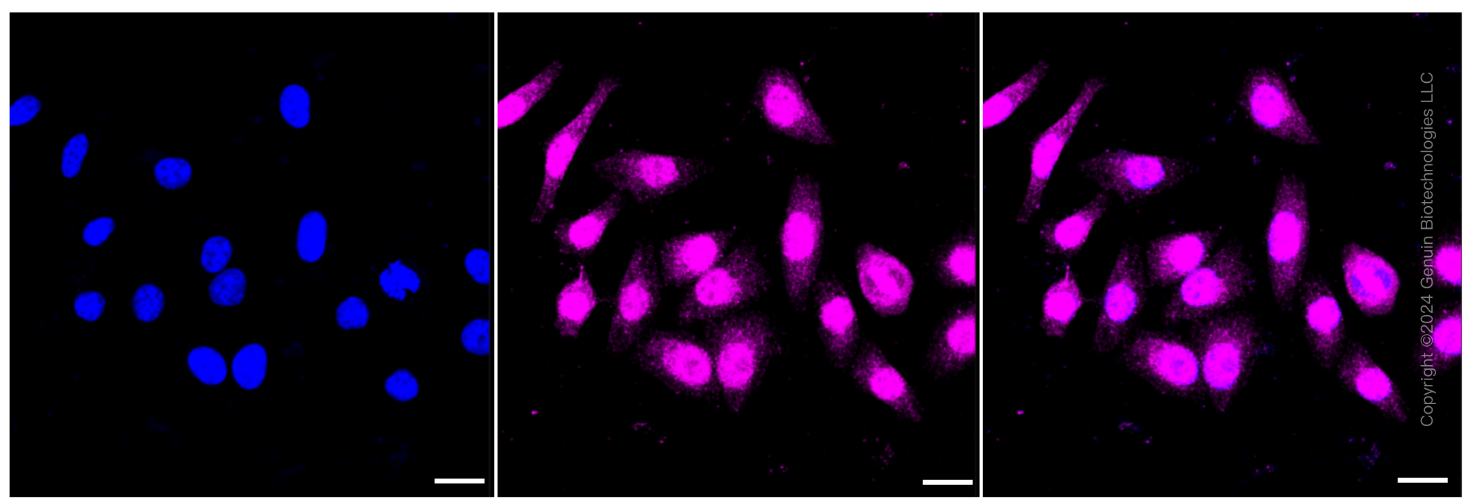 KD-Validated Anti-ANP32B Rabbit Monoclonal Antibody ABG1212