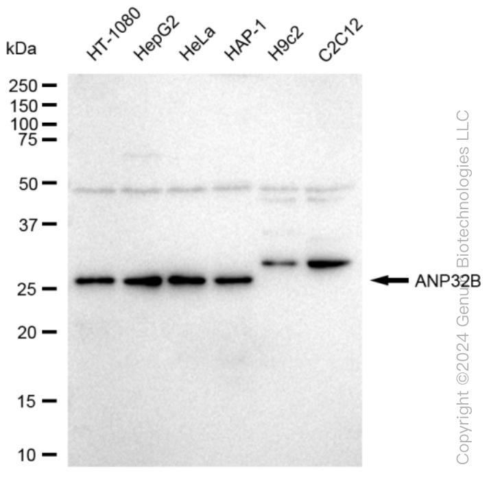 KD-Validated Anti-ANP32B Rabbit Monoclonal Antibody ABG1212