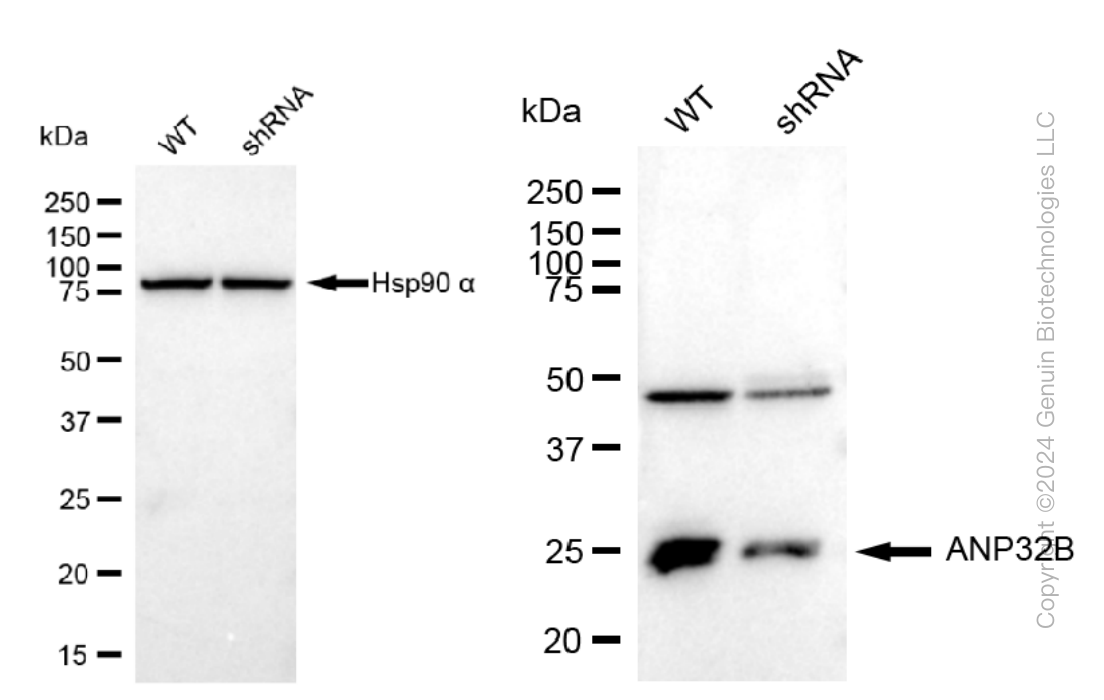 KD-Validated Anti-ANP32B Rabbit Monoclonal Antibody ABG1212