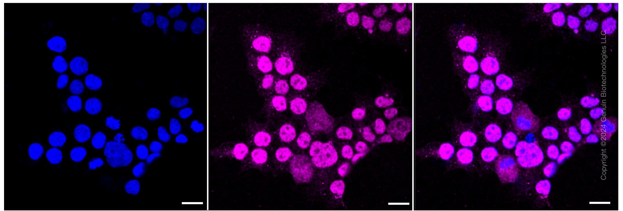 KD-Validated Anti-ACBD3 Rabbit Monoclonal Antibody ABG1215