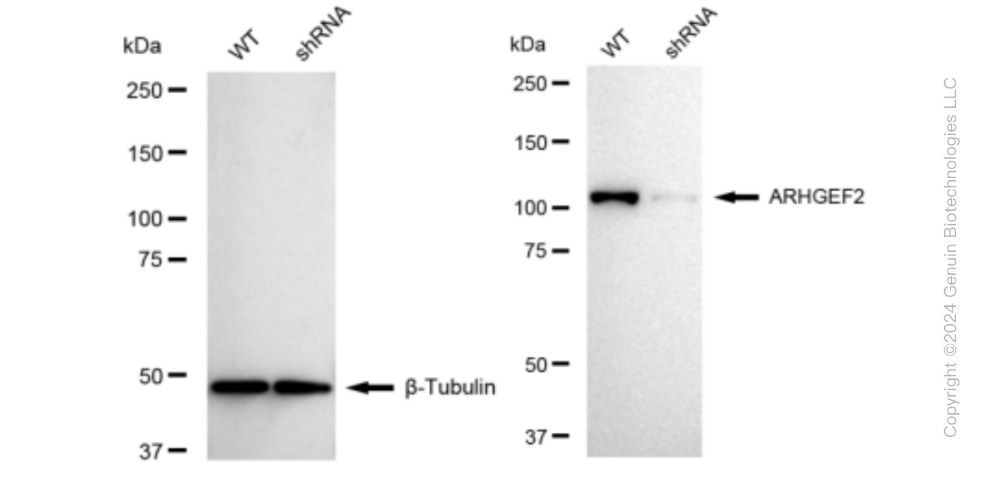 KD-Validated Anti-ARHGEF2 Rabbit Monoclonal Antibody ABG1217