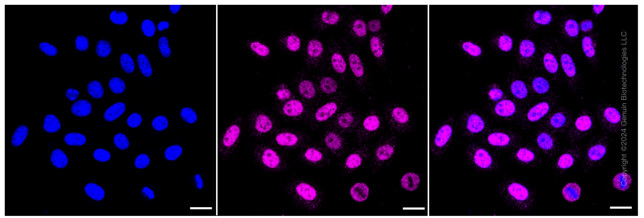 KD-Validated Anti-Casein kinase 2 beta Rabbit Monoclonal Antibody ABG1219