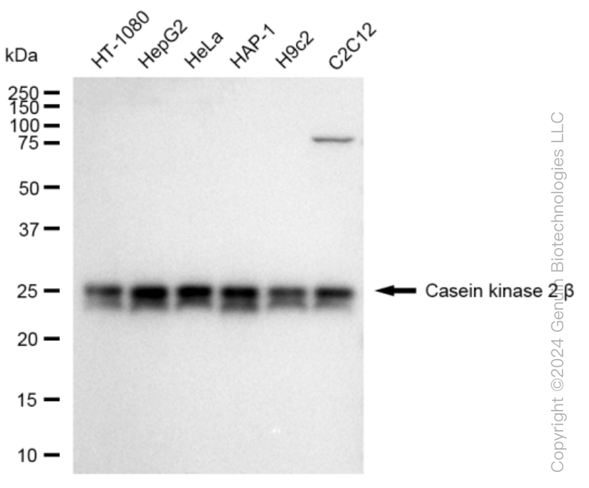 KD-Validated Anti-Casein kinase 2 beta Rabbit Monoclonal Antibody ABG1219