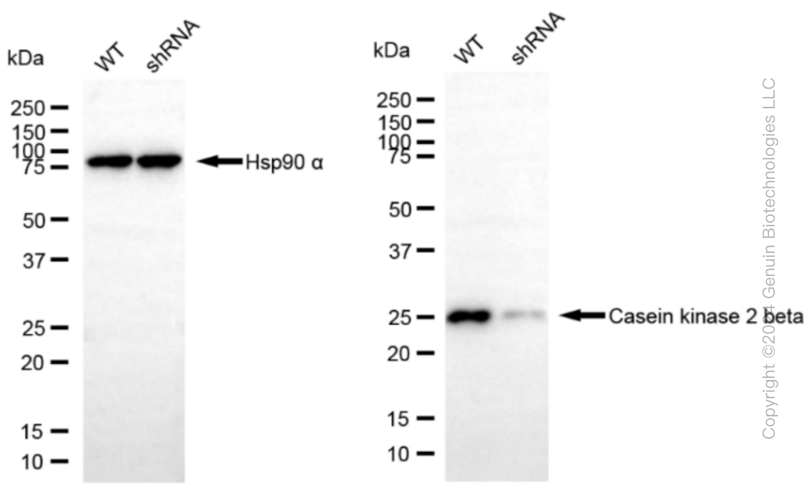 KD-Validated Anti-Casein kinase 2 beta Rabbit Monoclonal Antibody ABG1219