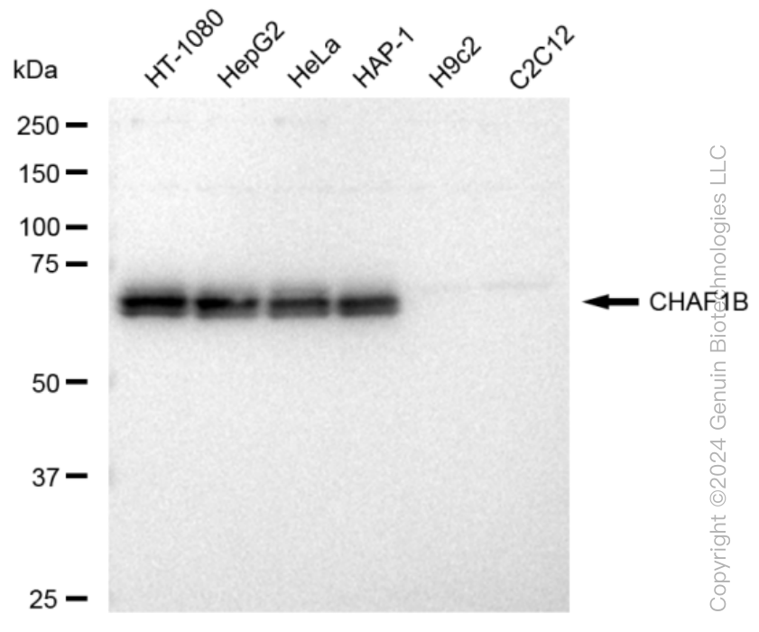KD-Validated Anti-CHAF1B Rabbit Monoclonal Antibody ABG1222