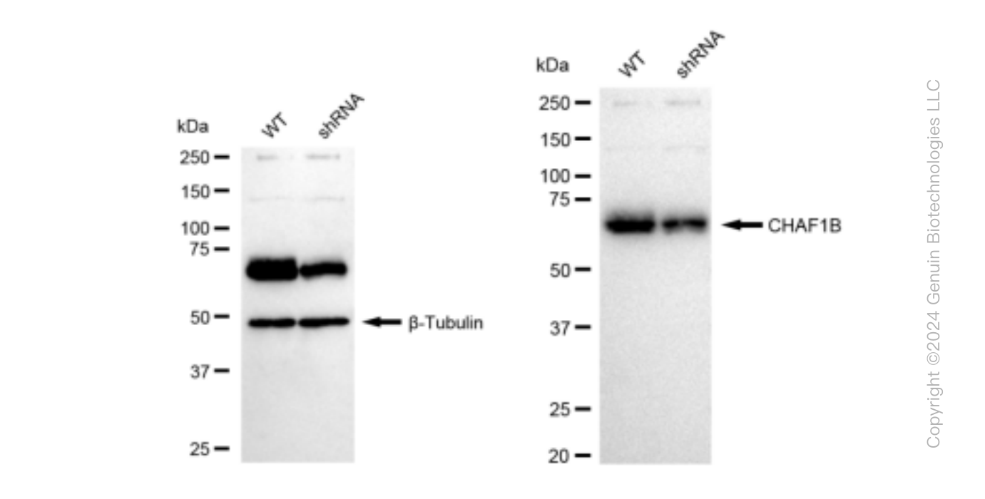 KD-Validated Anti-CHAF1B Rabbit Monoclonal Antibody ABG1222