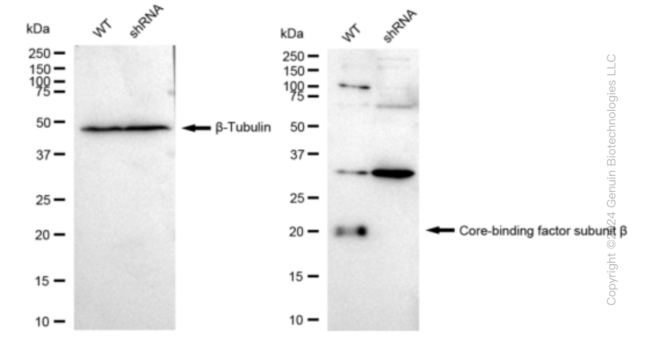 KD-Validated Anti-Core-binding factor subunit beta Rabbit Monoclonal Antibody ABG1223
