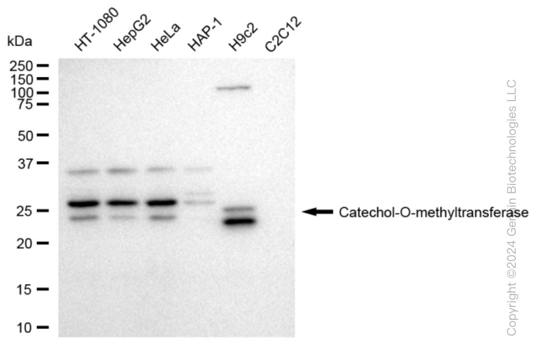 KD-Validated Anti-Catechol-O-methyltransferase Rabbit Monoclonal Antibody ABG1224