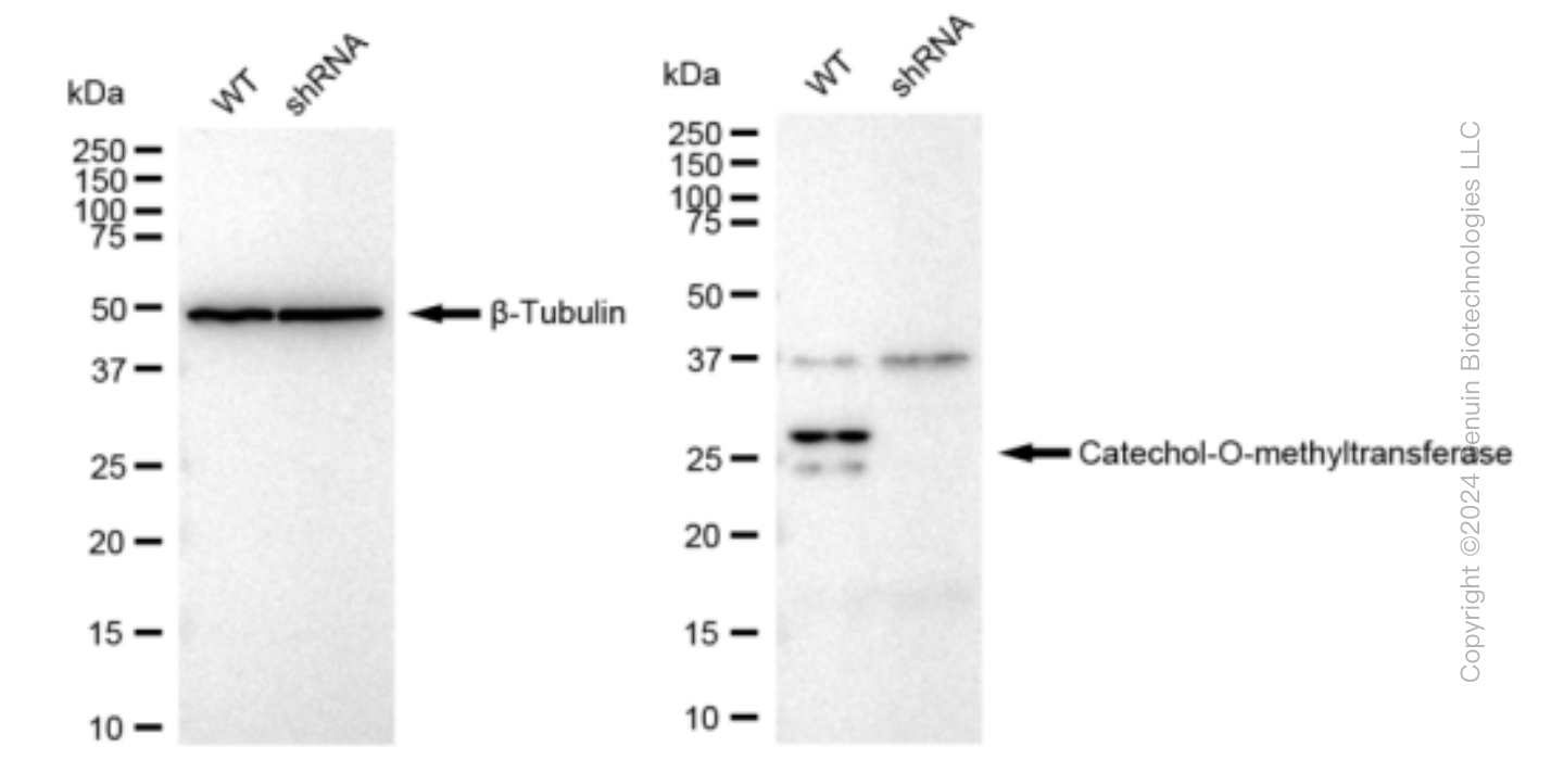 KD-Validated Anti-Catechol-O-methyltransferase Rabbit Monoclonal Antibody ABG1224