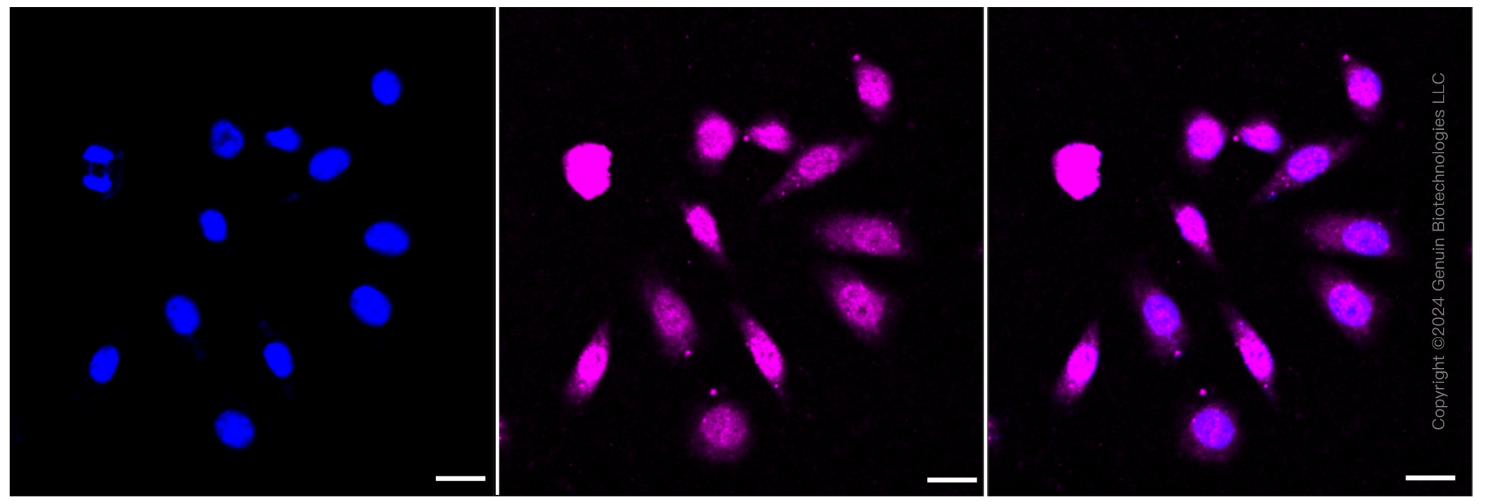 KD-Validated Anti-ACADVL Rabbit Monoclonal Antibody ABG1225