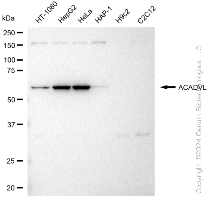KD-Validated Anti-ACADVL Rabbit Monoclonal Antibody ABG1225