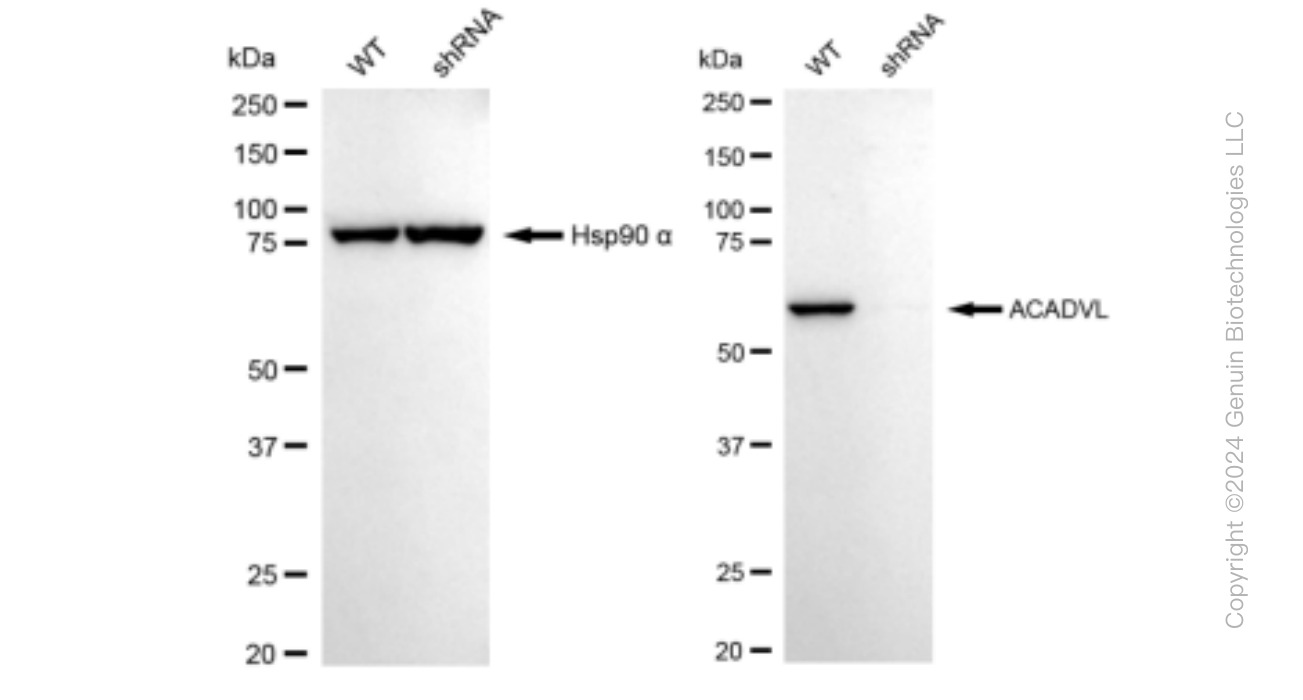 KD-Validated Anti-ACADVL Rabbit Monoclonal Antibody ABG1225