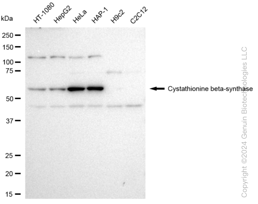 KD-Validated Anti-Cystathionine beta-synthase Rabbit Monoclonal Antibody ABG1226