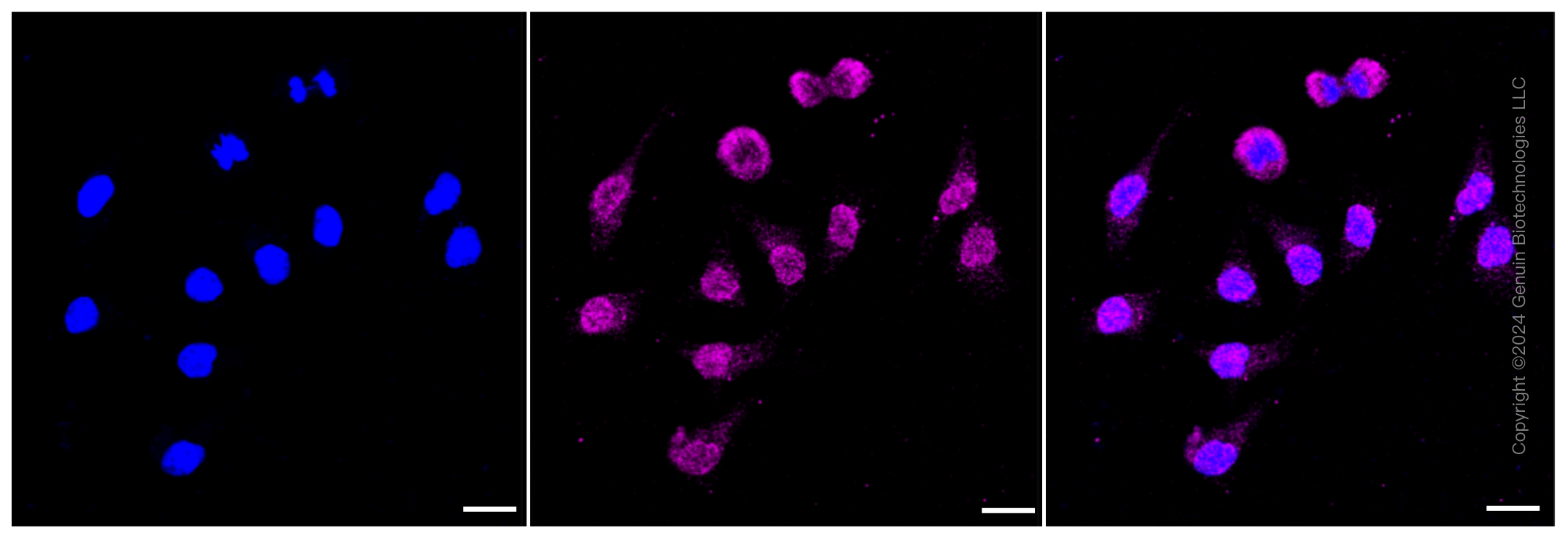 KD-Validated Anti-CD105 Rabbit Monoclonal Antibody ABG1227