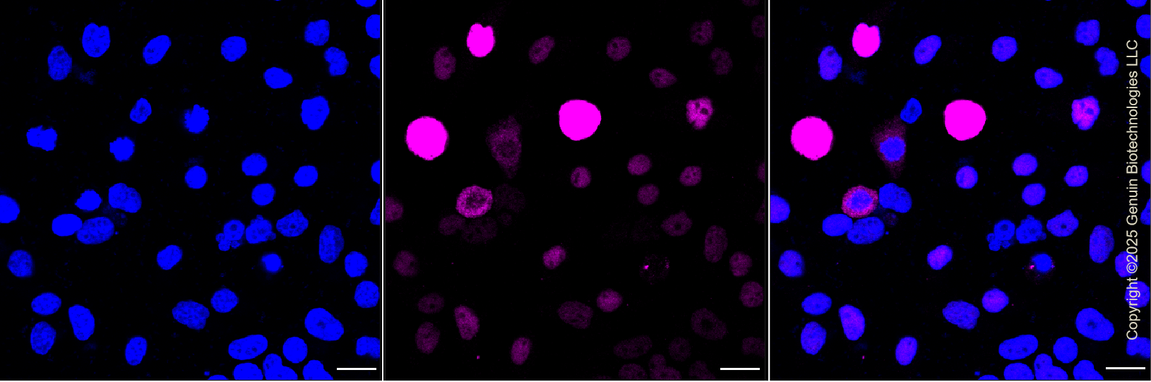 KD-Validated Anti-Phospho-c-Myc (S62) Rabbit Monoclonal Antibody ABG1228