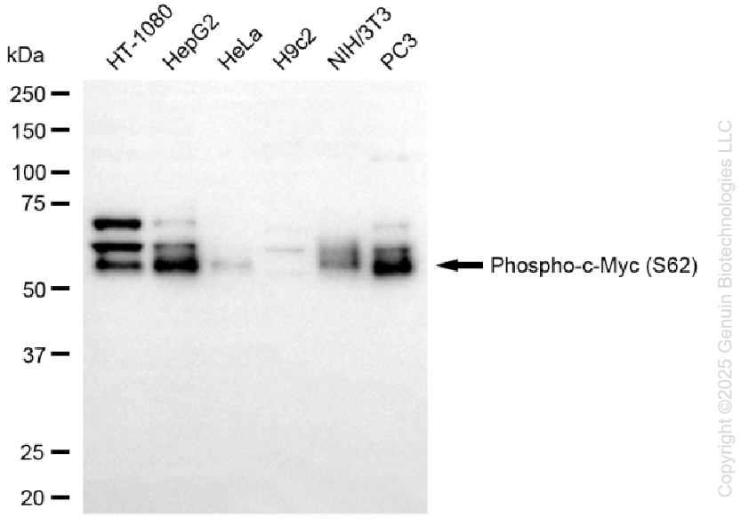 KD-Validated Anti-Phospho-c-Myc (S62) Rabbit Monoclonal Antibody ABG1228