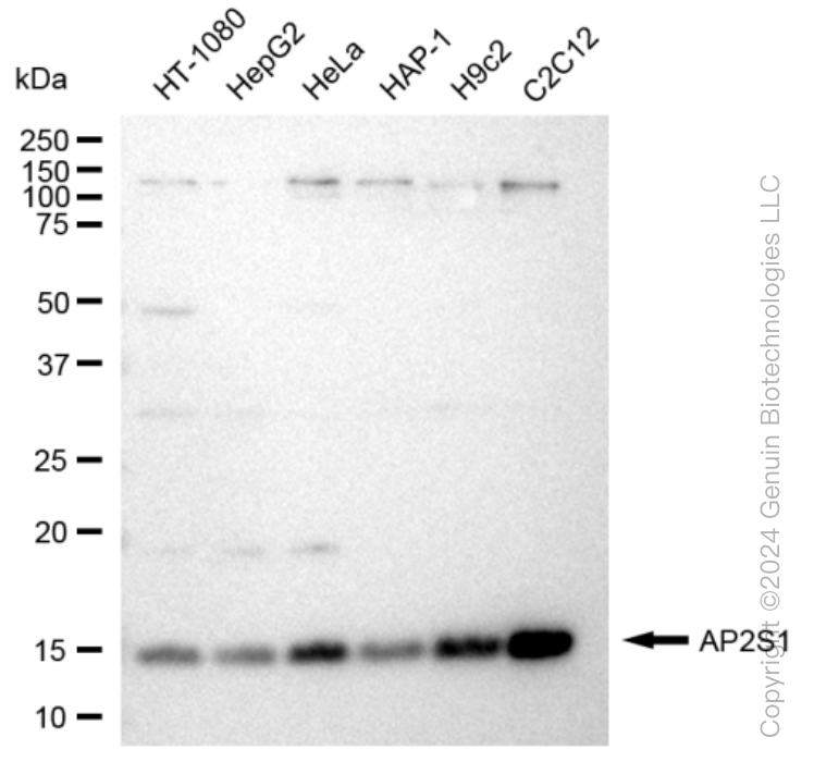 KD-Validated Anti-AP2S1 Rabbit Monoclonal Antibody ABG1229