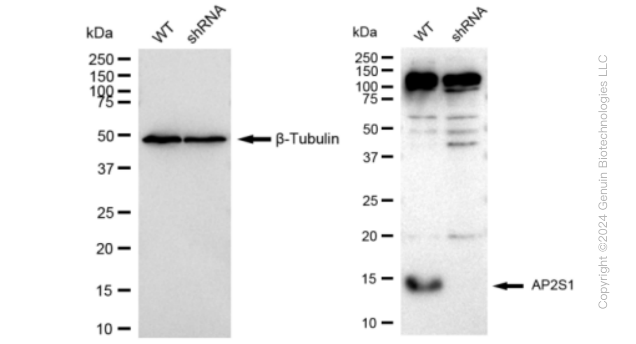 KD-Validated Anti-AP2S1 Rabbit Monoclonal Antibody ABG1229