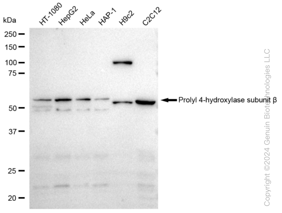 KD-Validated Anti-Prolyl 4-hydroxylase subunit beta Rabbit Monoclonal Antibody ABG1234