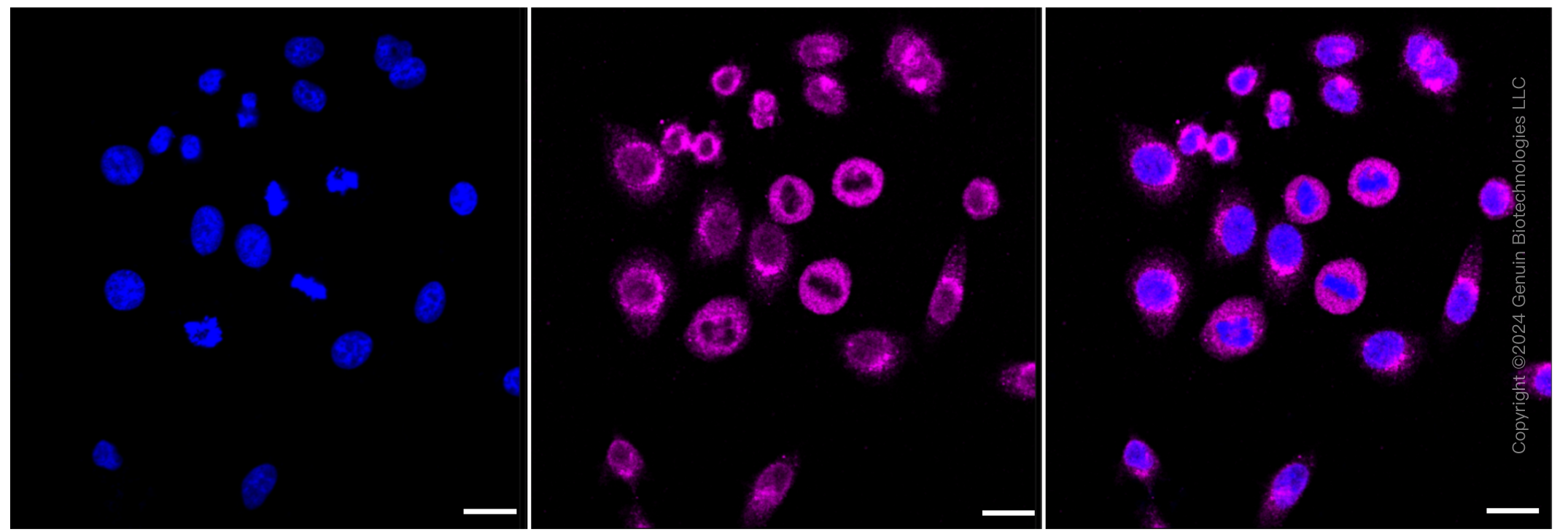 KD-Validated Anti-LMAN1 Rabbit Monoclonal Antibody ABG1247