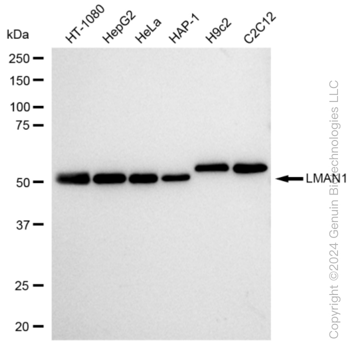 KD-Validated Anti-LMAN1 Rabbit Monoclonal Antibody ABG1247