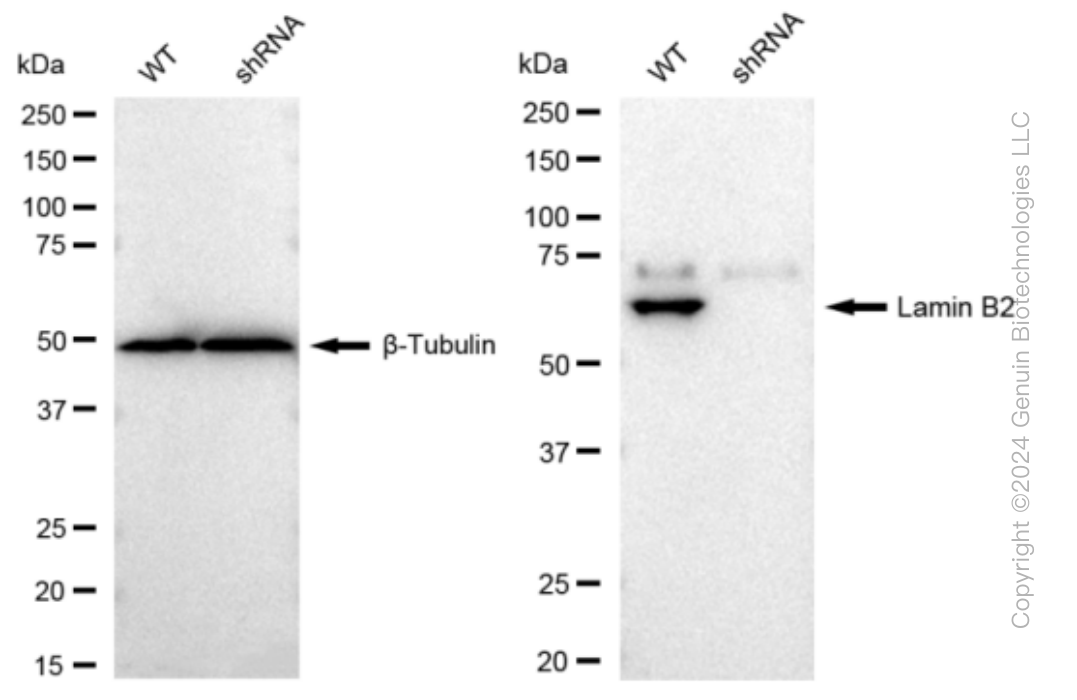 KD-Validated Anti-Lamin B2 Rabbit Monoclonal Antibody ABG1248