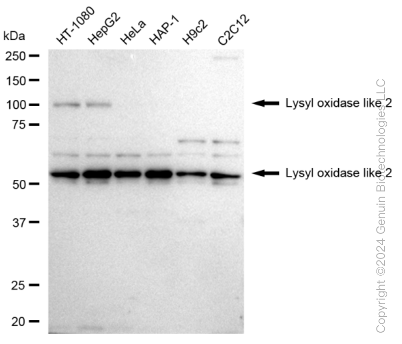 KD-Validated Anti-Lysyl oxidase like 2 Rabbit Monoclonal Antibody ABG1249