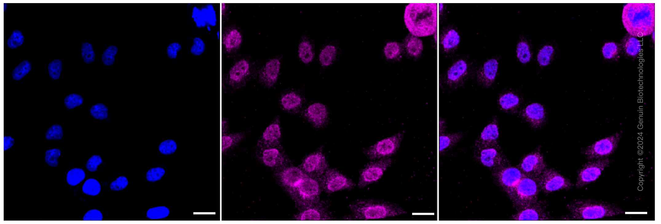 KD-Validated Anti-LDL receptor related protein 8 Rabbit Monoclonal Antibody ABG1250