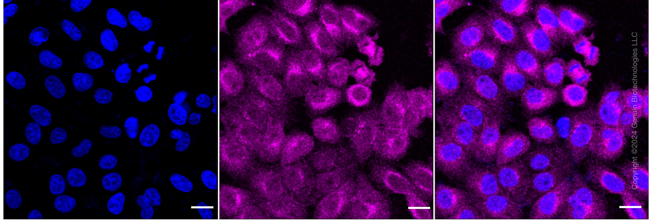 KD-Validated Anti-ERK1 Rabbit Monoclonal Antibody ABG1251