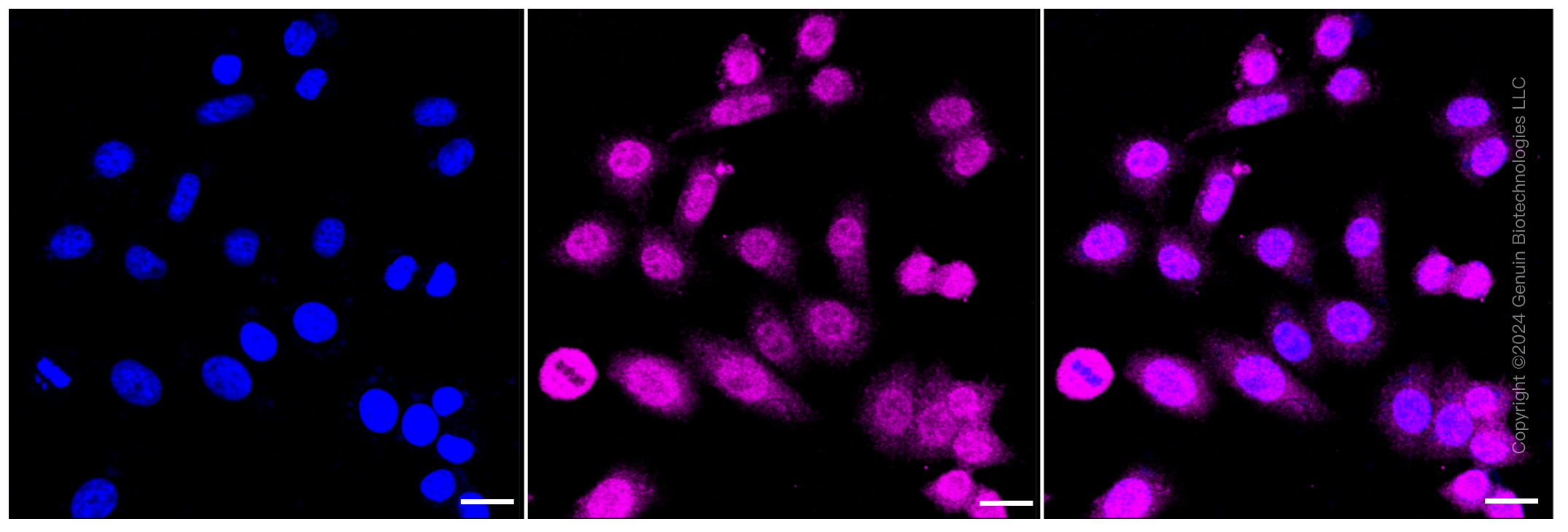 KD-Validated Anti-ERK1 Rabbit Monoclonal Antibody ABG1252