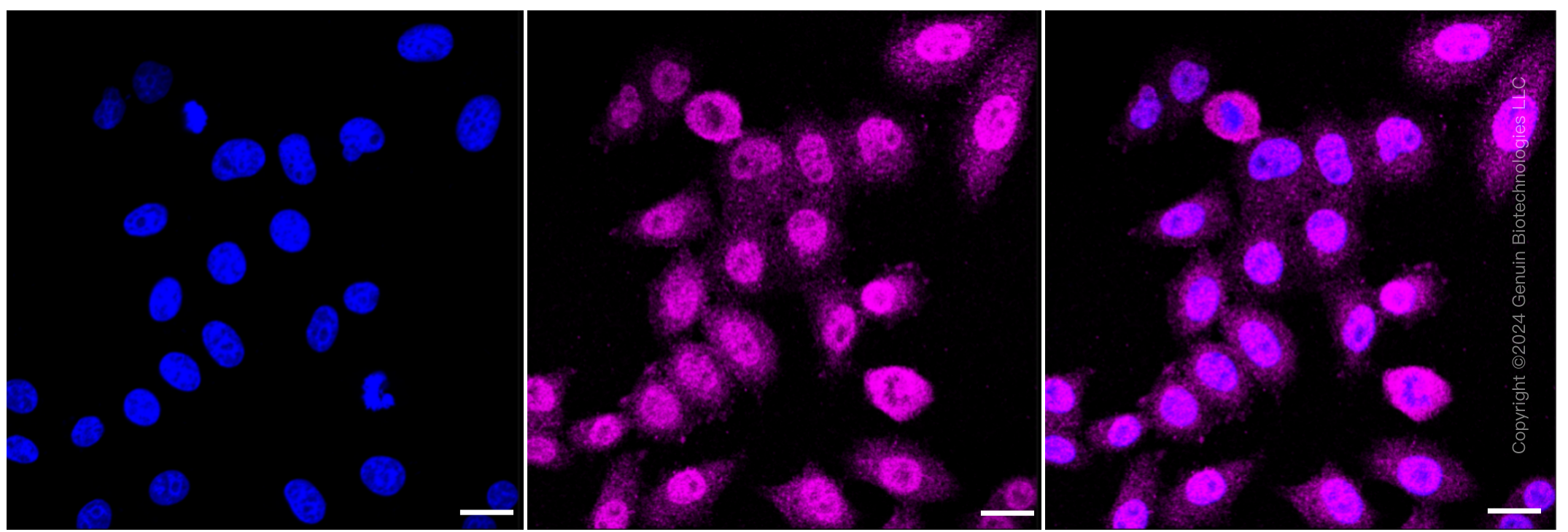 KD-Validated Anti-MAPK activated protein kinase 2 Rabbit Monoclonal Antibody ABG1253