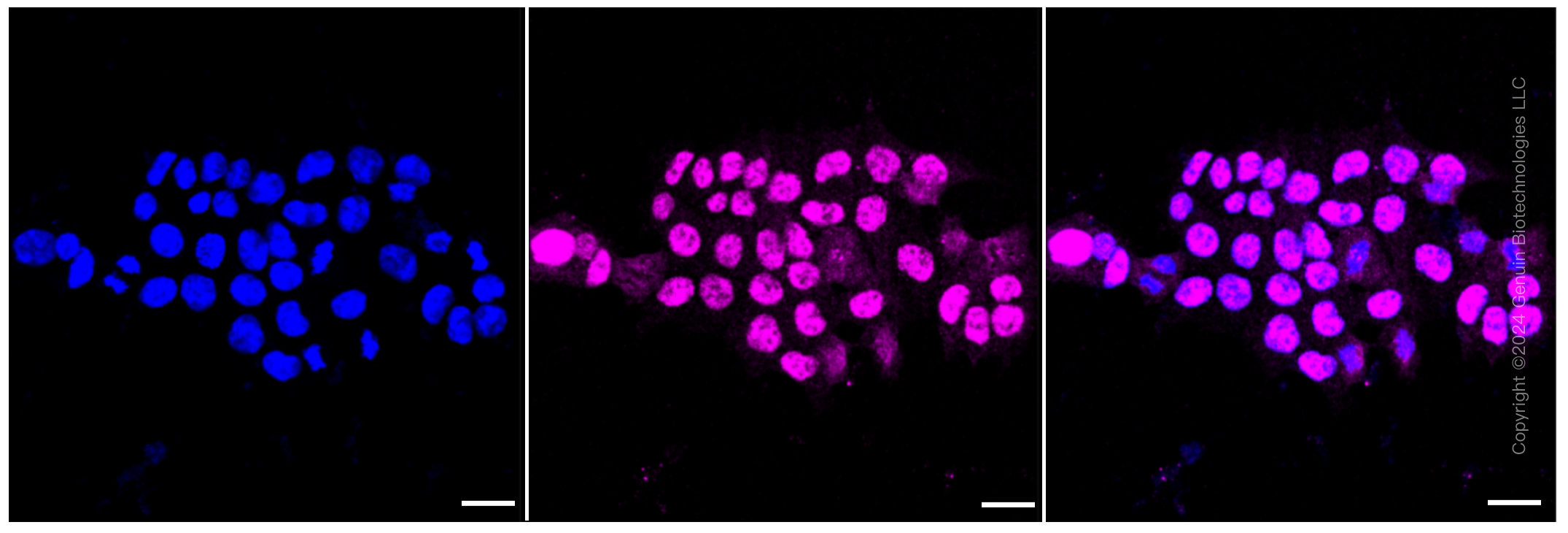 KD-Validated Anti-MAPK activated protein kinase 2 Rabbit Monoclonal Antibody ABG1254