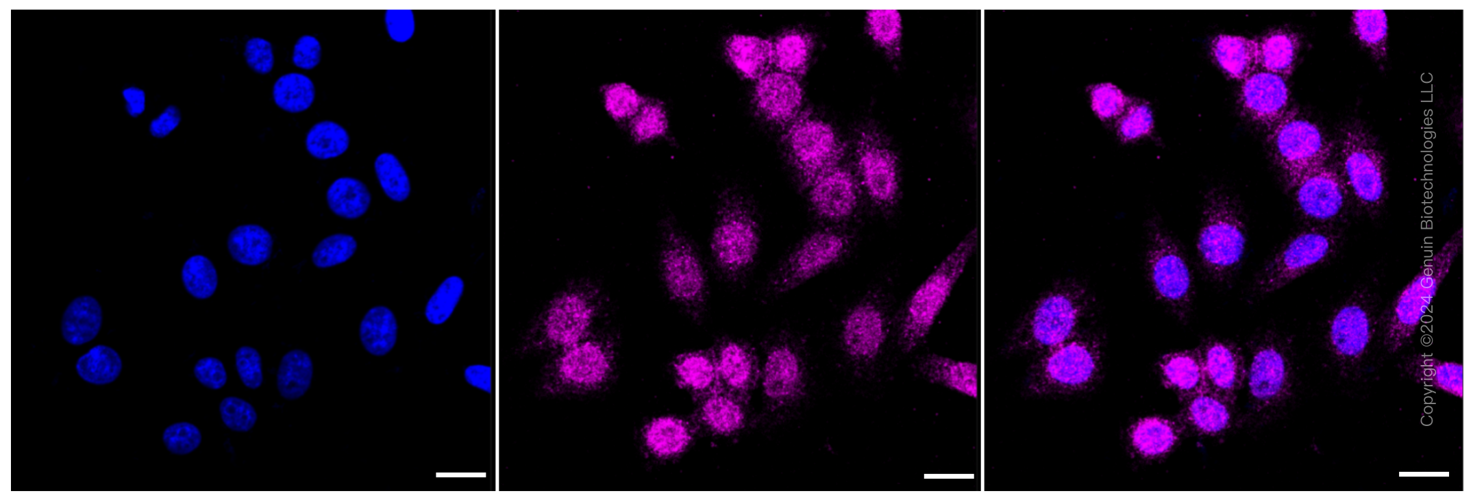 KD-Validated Anti-CD146 Rabbit Monoclonal Antibody ABG1255