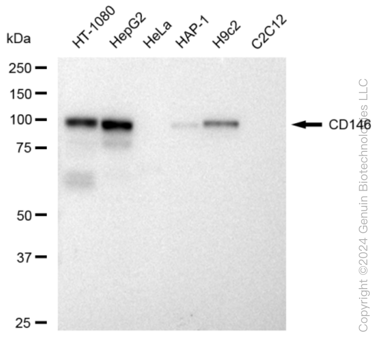 KD-Validated Anti-CD146 Rabbit Monoclonal Antibody ABG1255