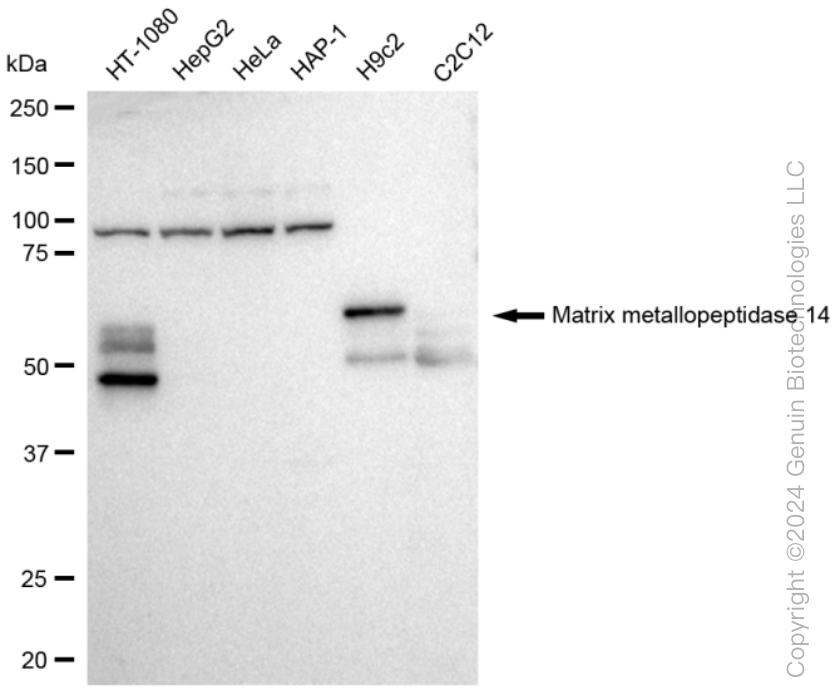 KD-Validated Anti-Matrix metallopeptidase 14 Rabbit Monoclonal Antibody ABG1260