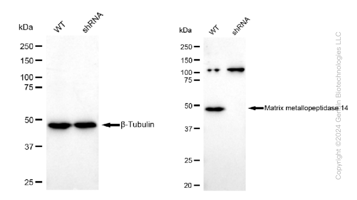 KD-Validated Anti-Matrix metallopeptidase 14 Rabbit Monoclonal Antibody ABG1260