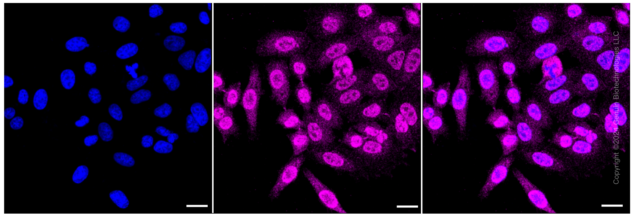 KD-Validated Anti-PAFAH1B1 Rabbit Monoclonal Antibody ABG1262