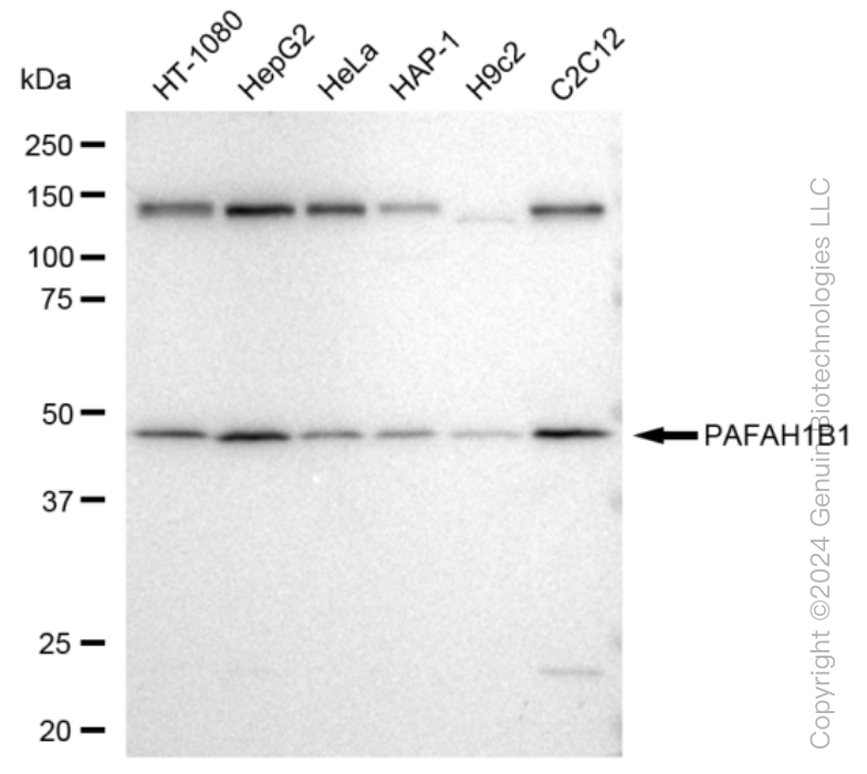 KD-Validated Anti-PAFAH1B1 Rabbit Monoclonal Antibody ABG1262