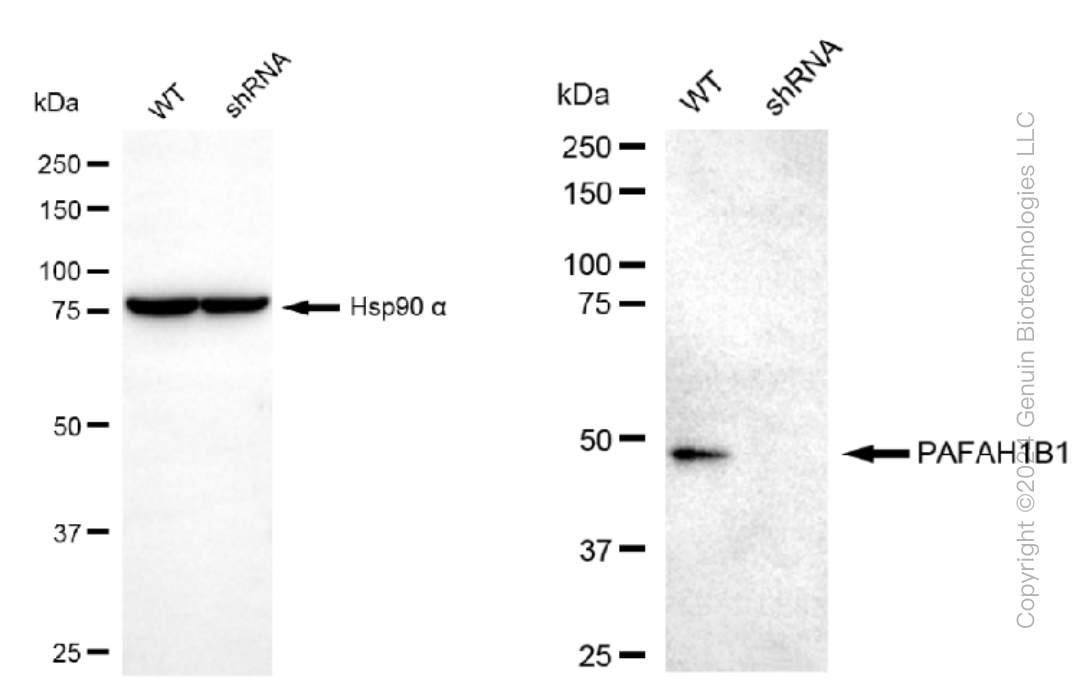 KD-Validated Anti-PAFAH1B1 Rabbit Monoclonal Antibody ABG1262