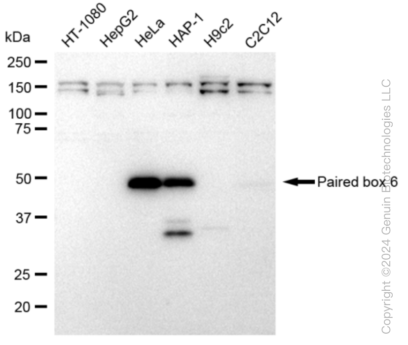 KD-Validated Anti-Paired box 6 Rabbit Monoclonal Antibody ABG1263